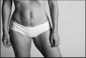 El cuerpo hay que mostrarlo, tal y como es