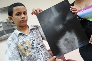 Juan Romero, el niño al que le salio en la imagen la figura de Jose Gregorio Hernández.  